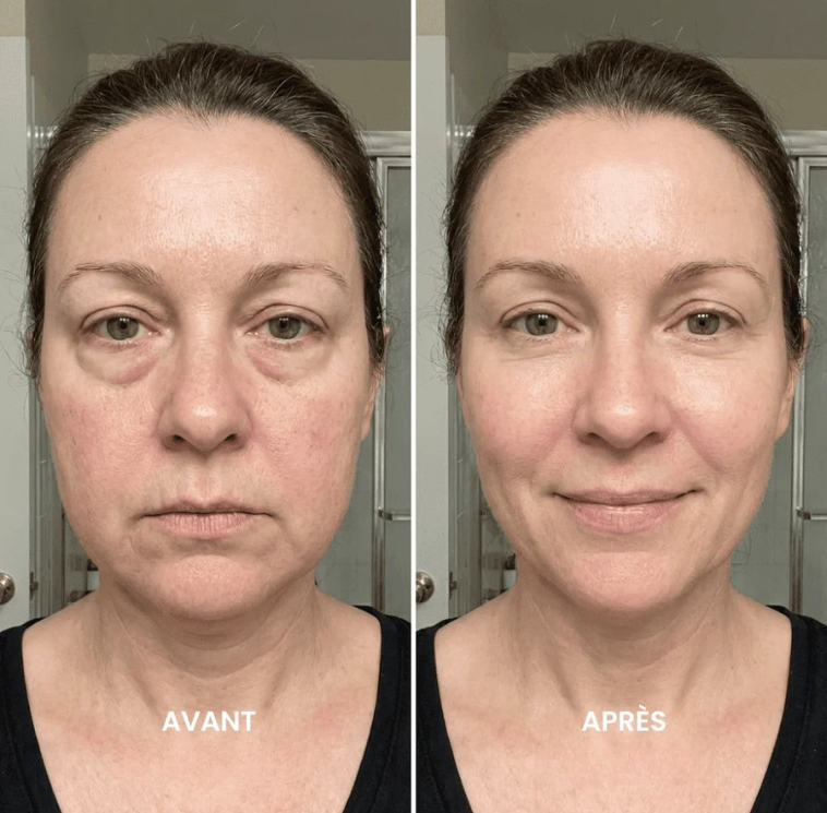 Brosse drainage lymphatique visage
